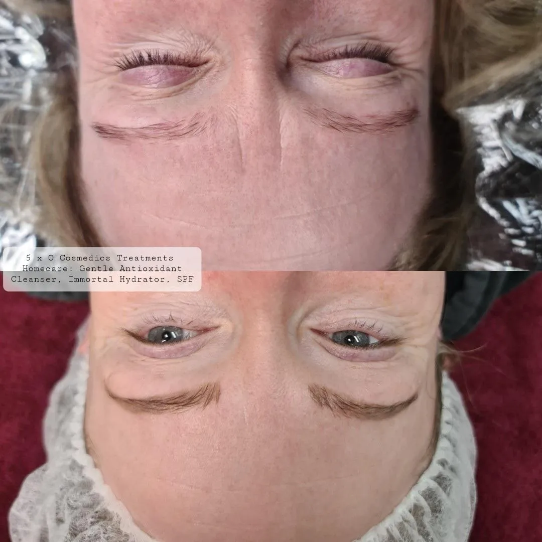 Bec's before-and-after photo showing remarkable reduction in eye wrinkles and clearer skin, achieved with minimal O Cosmedics products in a short time span.