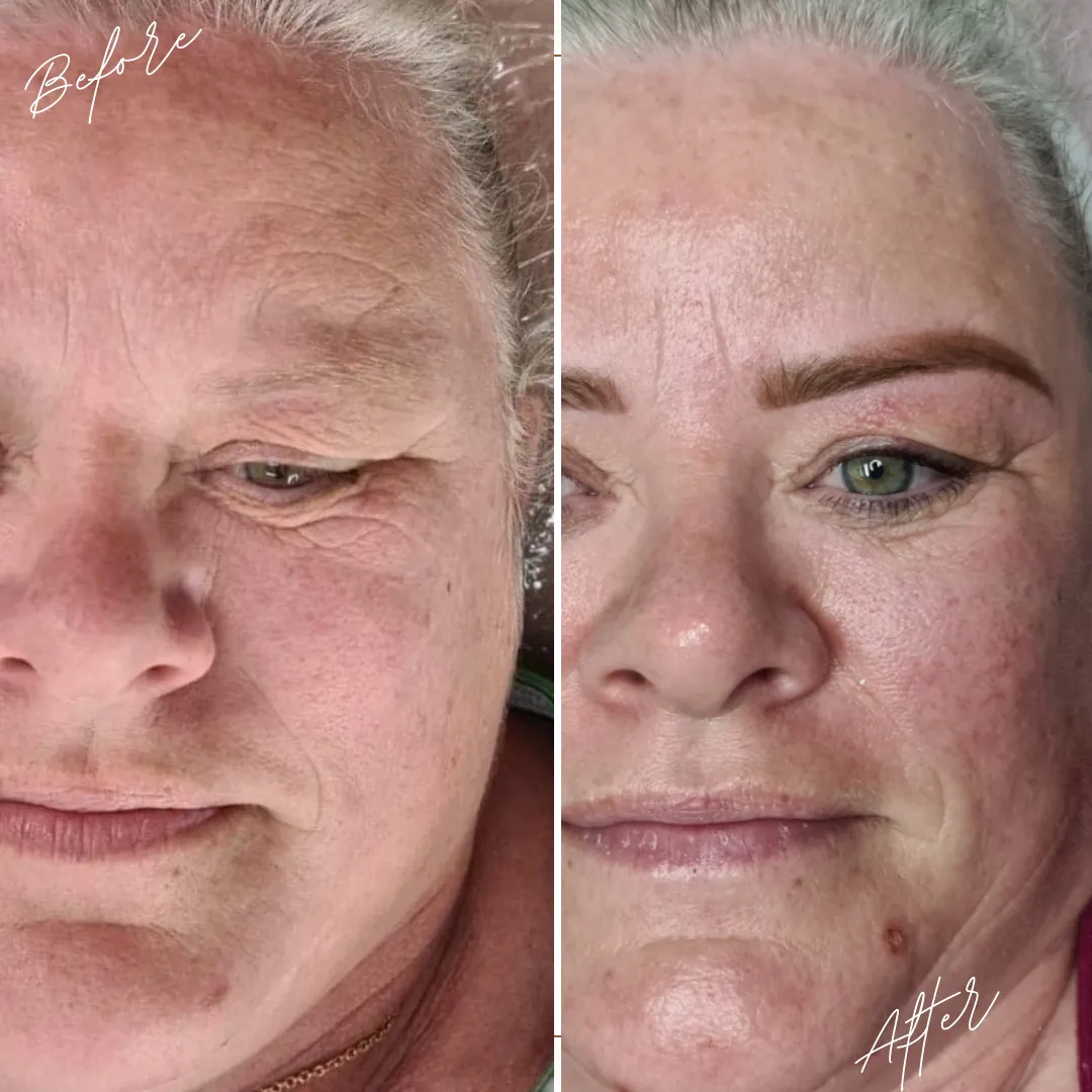 before and after skin transformation of aged skin