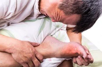 What triggered your gout attack?
