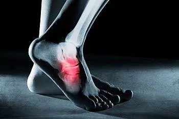 Explore the ins and outs of navicular stress fracture