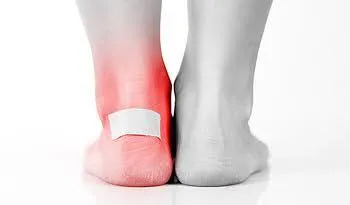 Resist the urge to pop that blister!