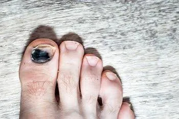 Run happy, toes healthy!