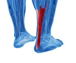 Achilles pain could be bad news