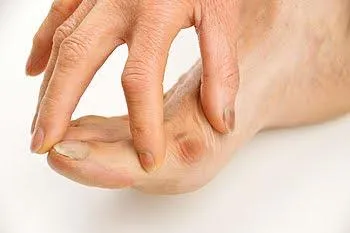 Bunions: Can they me reversed?