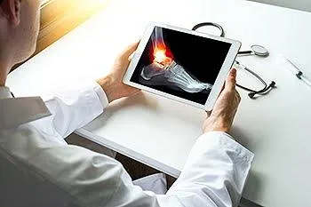 Understanding a broken foot bone