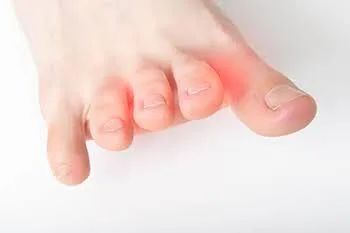 Pebble in paradise? Foot pain got you down?