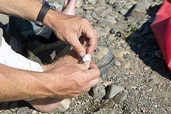 Simple Ways to Prevent Blisters
