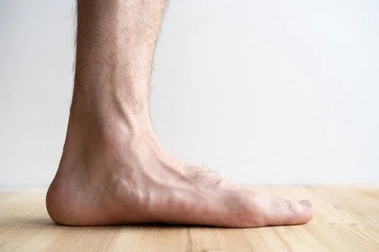 Flat feet? Check your soles