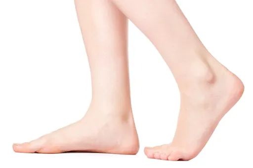When Are Flat Feet a Problem?