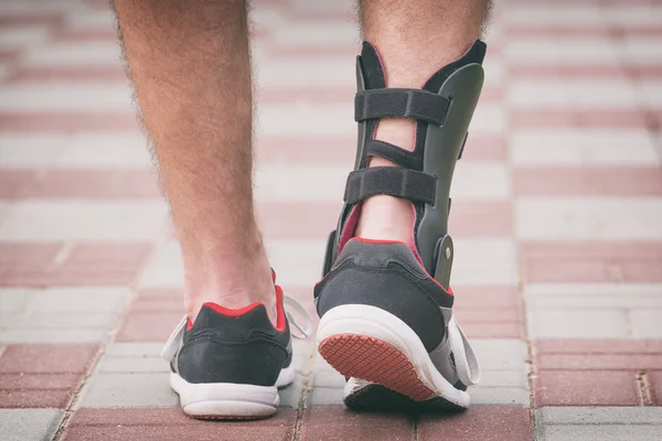 Use of Braces for Ankle Sprains