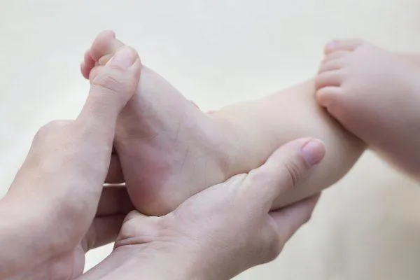 Treatment for Clubfoot