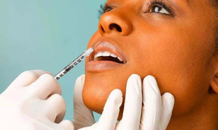 Lip Filler Raleigh NC