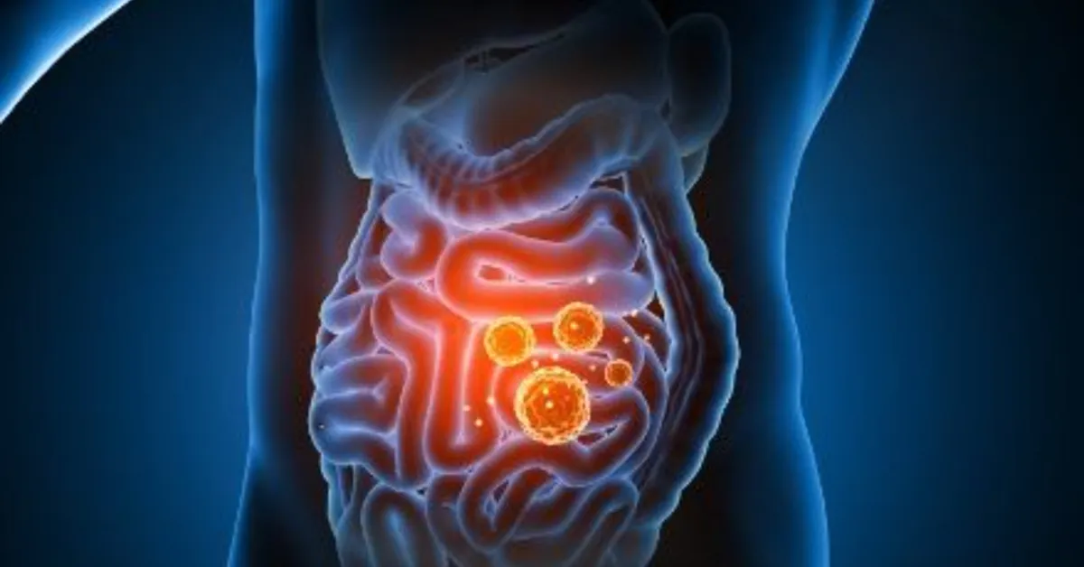 Leaky Gut