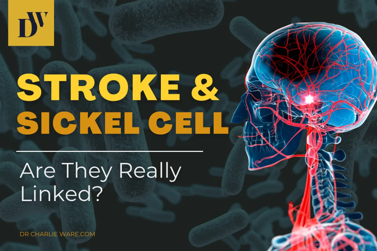 stroke and sickle cell - are they really linked?