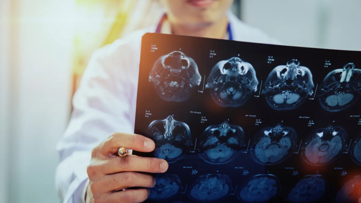 Doctor holding MRI scan film under bright light, symbolizing affordable medical imaging options like MRIs, CT scans, and X-rays without high hospital costs.
