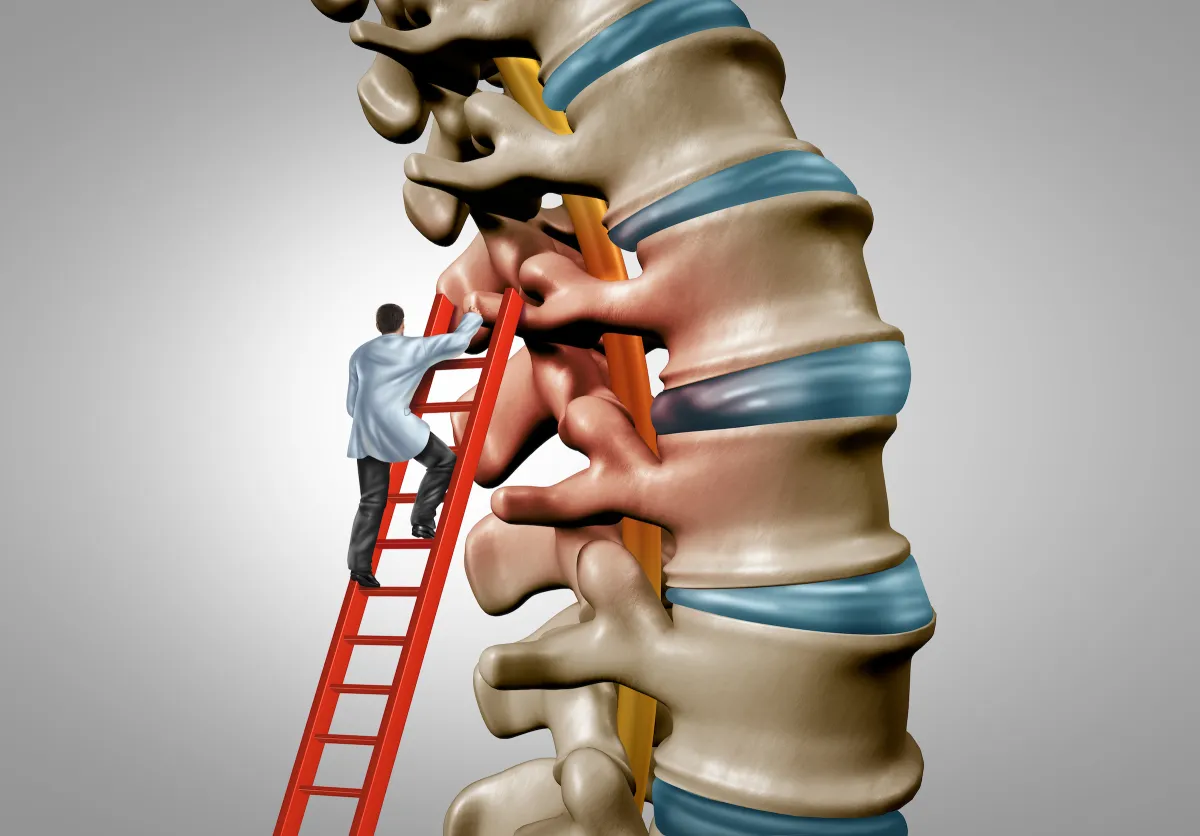 Lower back surgery, Spinal Surgery, Spinal Fusion