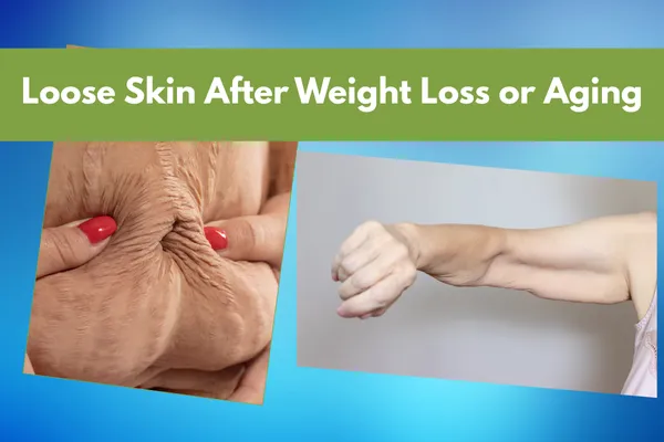 Loose Skin After Weight Loss or Aging? Rebuild Naturally with Ancestral Nutrition