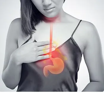 GERD? Heartburn? Maybe You Have Too Low Stomach Acid. How to Do the Hydrochloric Acid (HCL) Challenge