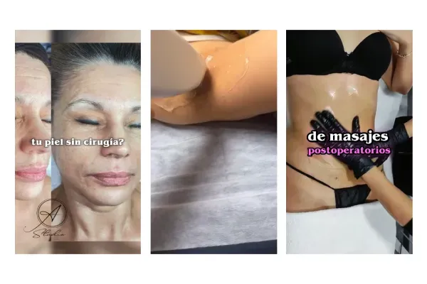 Video tipo Reel mostrando transformación estética para generar citas en spa