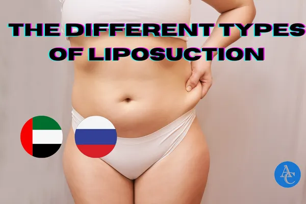 liposuction types