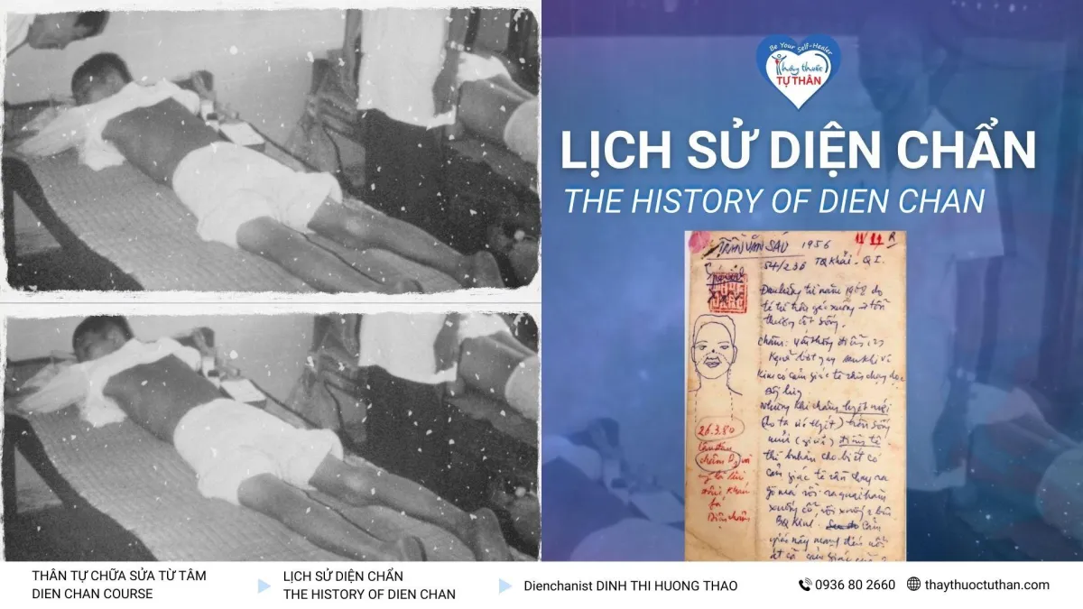 Lịch sử diện chẩn