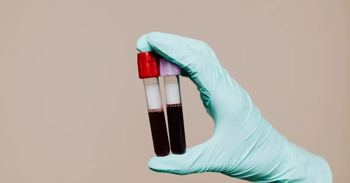 Bloodwork Basics for Testosterone Replacement Therapy: Key Labs, Target Ranges, and Monitoring Schedule