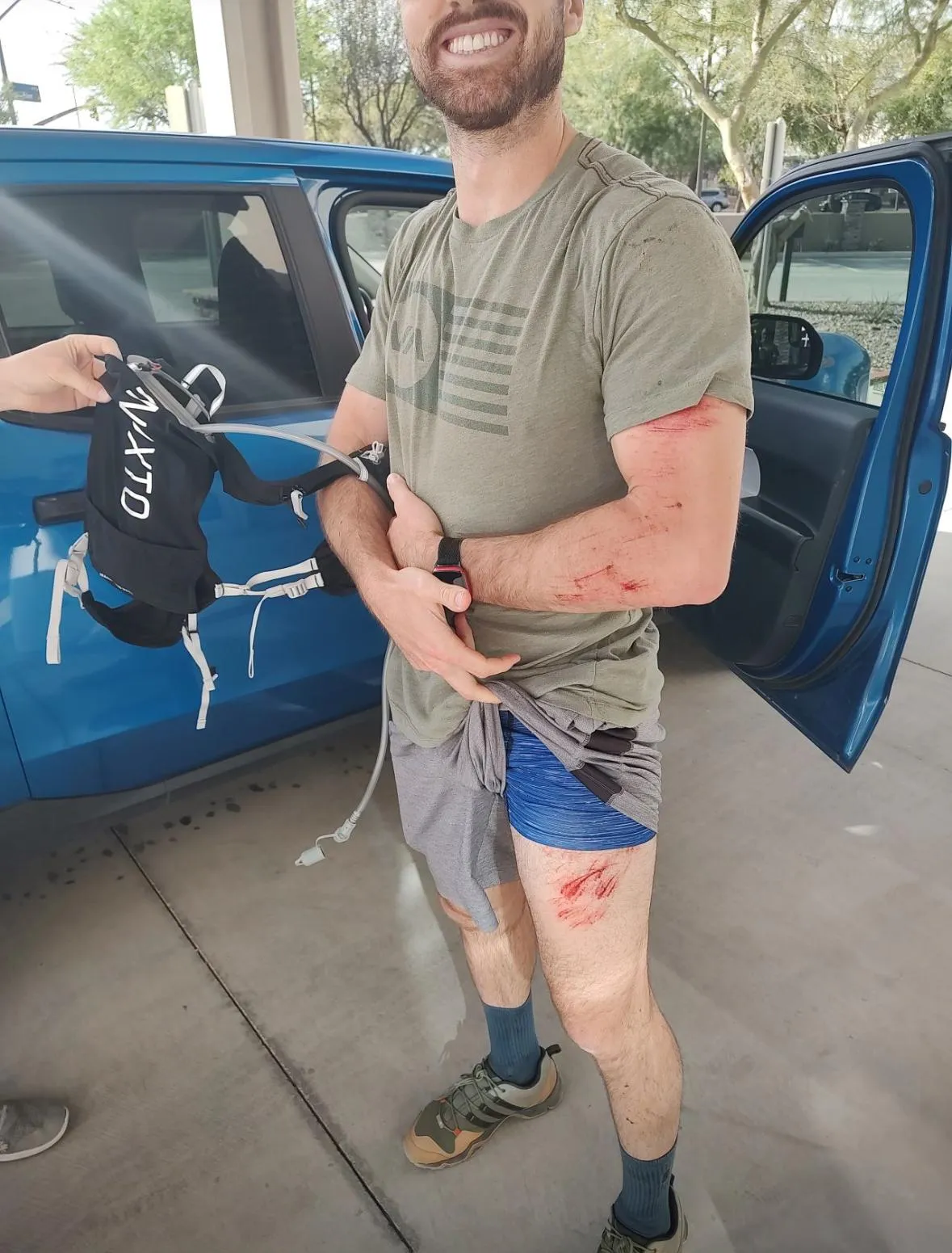 Zack after the crash