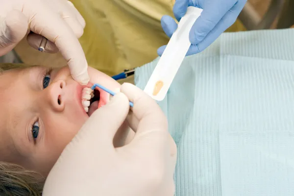 The Importance of Fluoride in Children's Dental Care