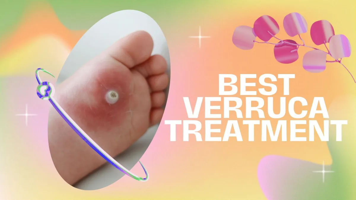 Best Verruca Treatment