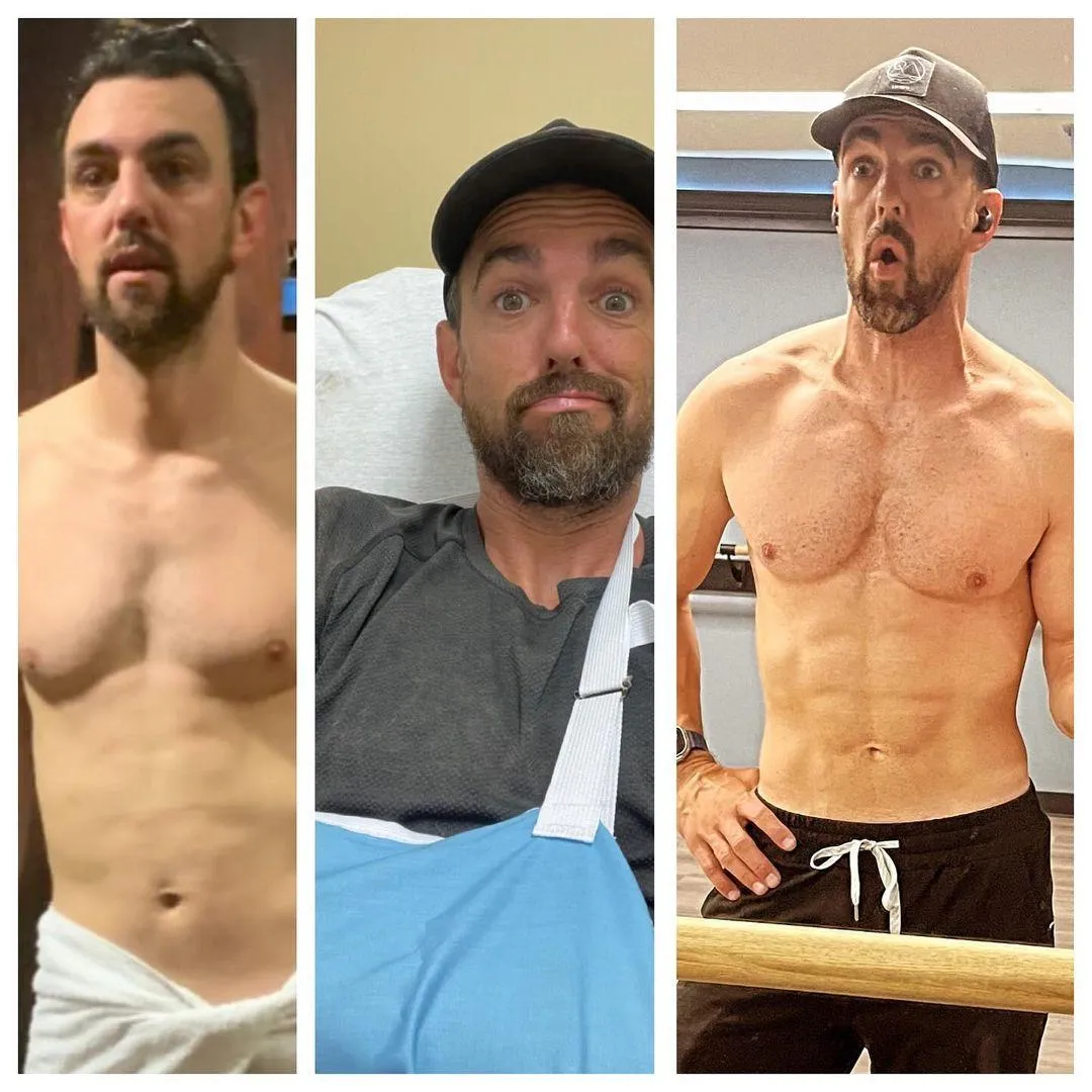 Tim Before Injured After