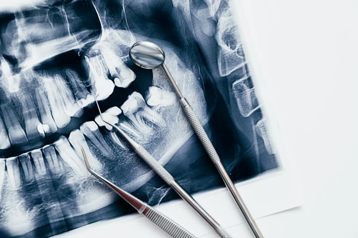 A dental X-ray