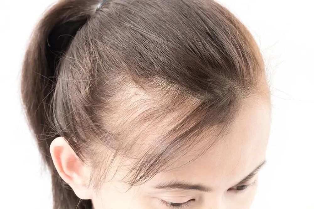 thin hair