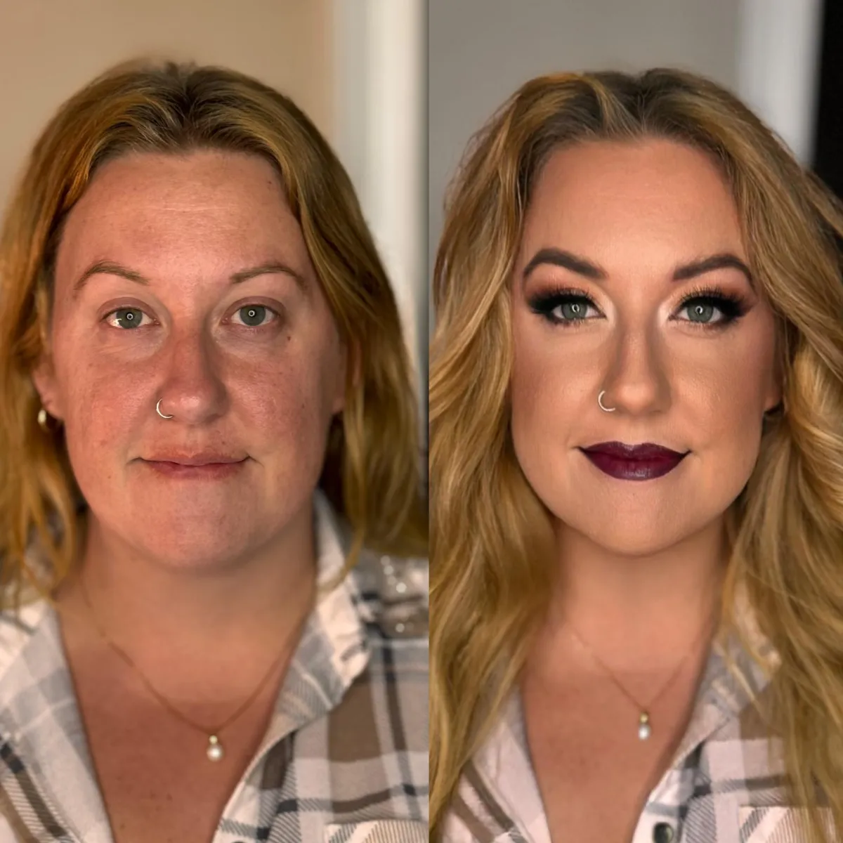 Before and After