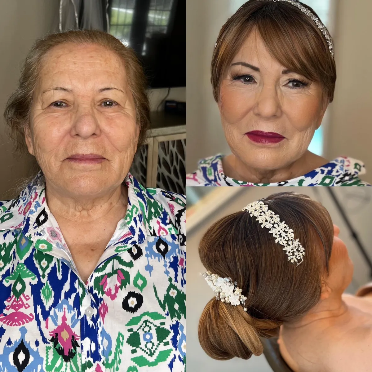 Before and After