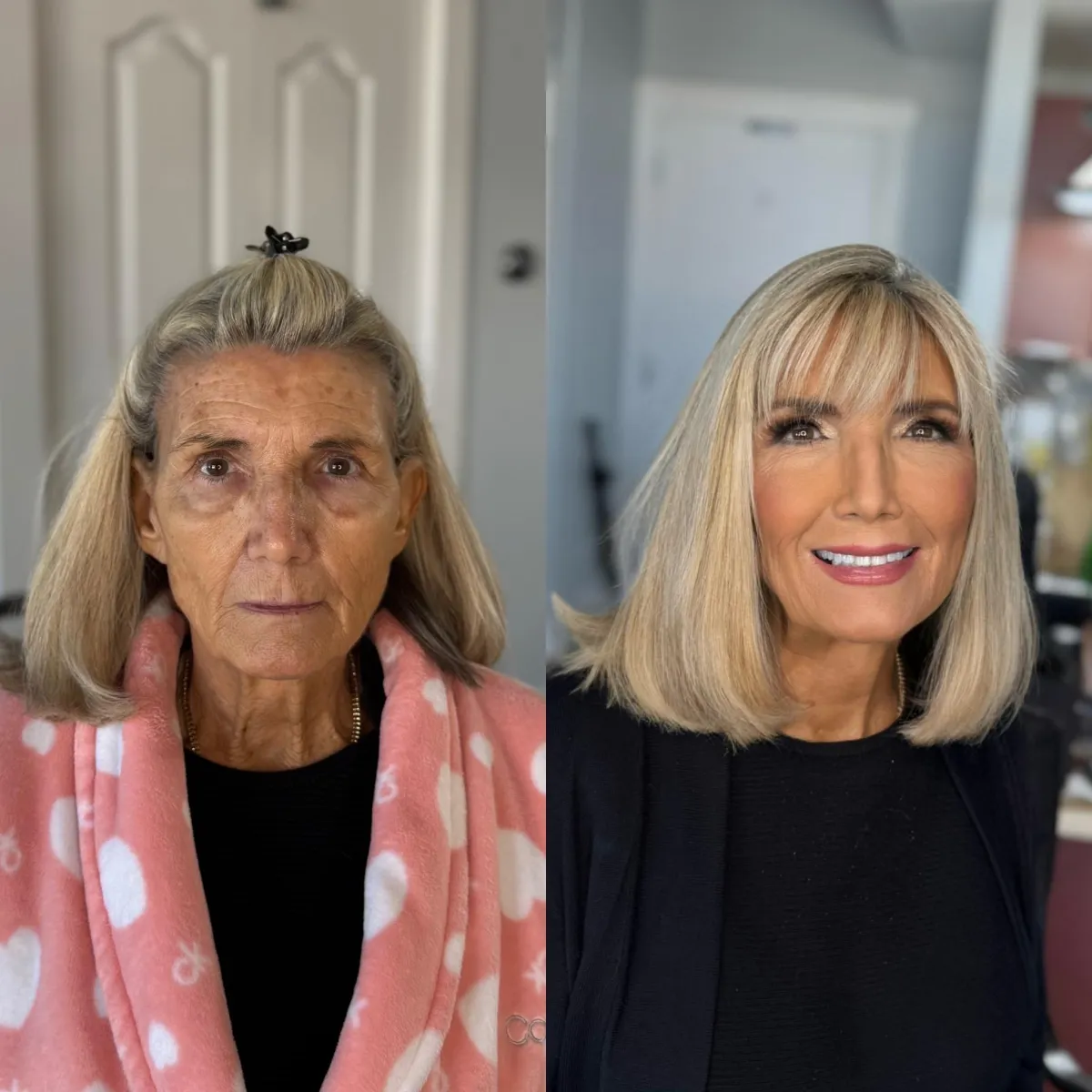 Before and After