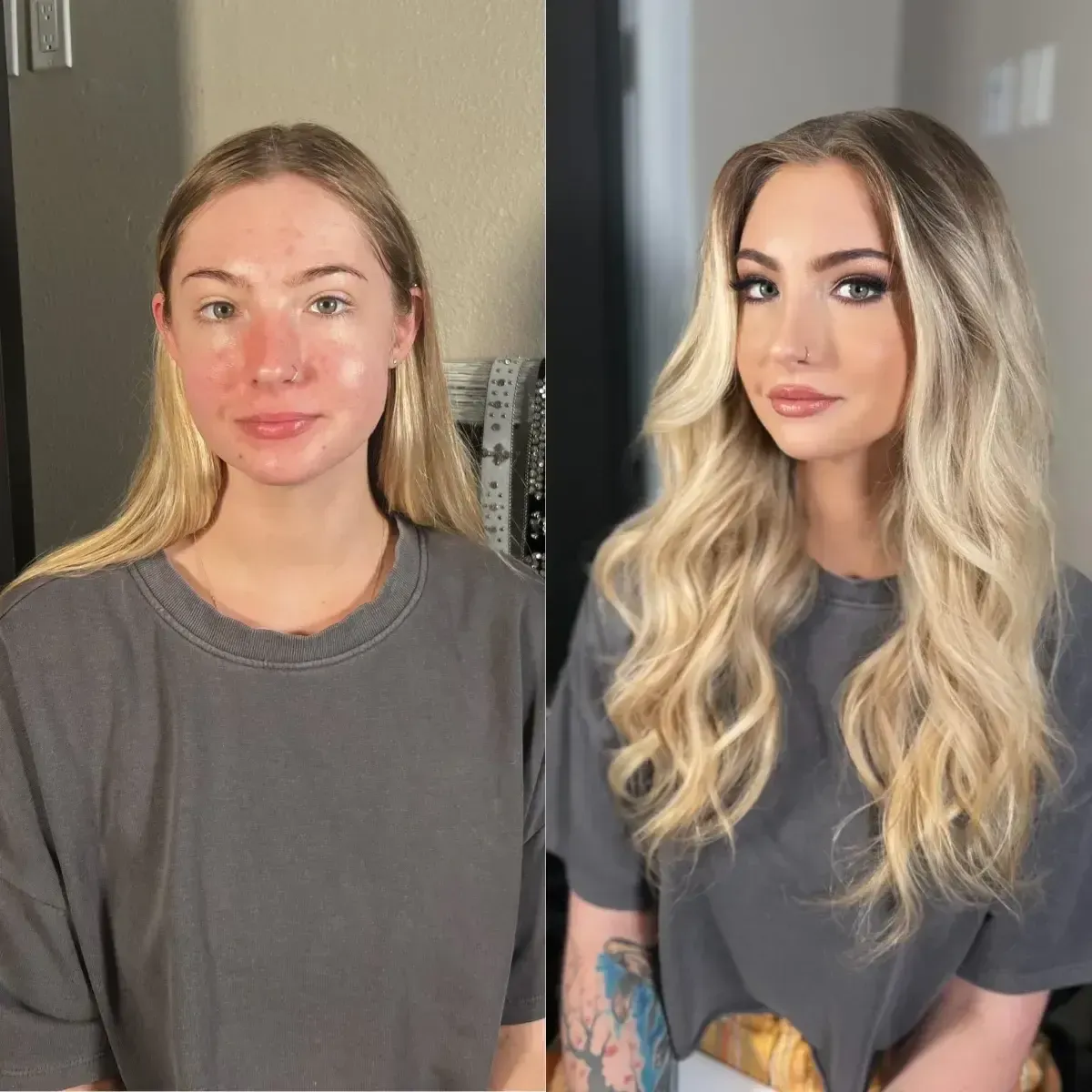 Before and After