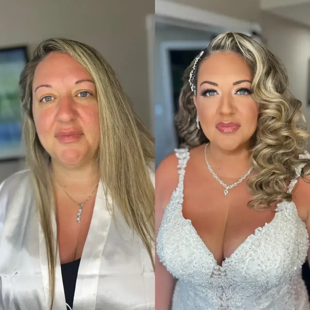 Before and After