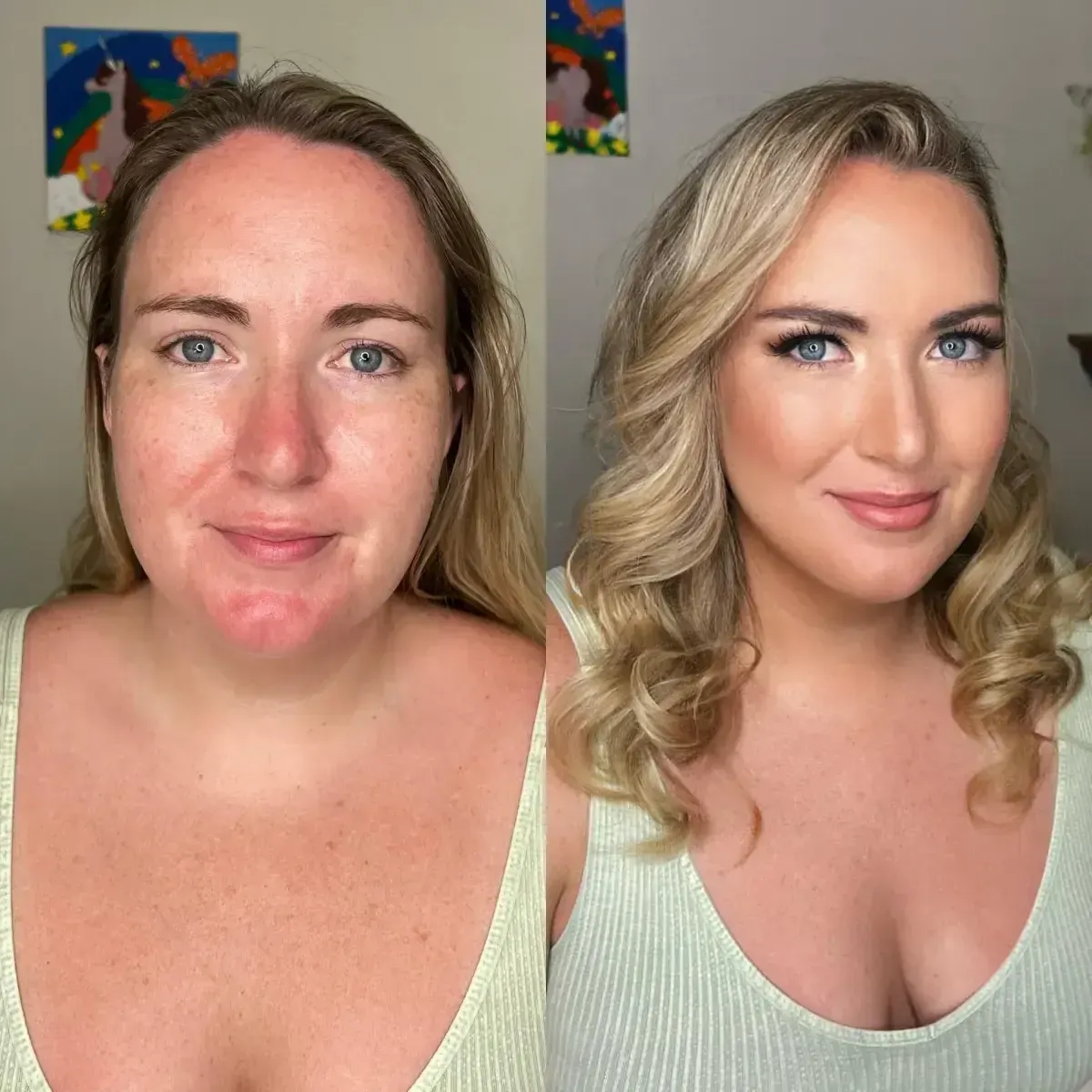 Before and After