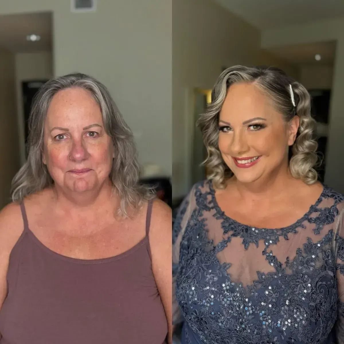 Before and After