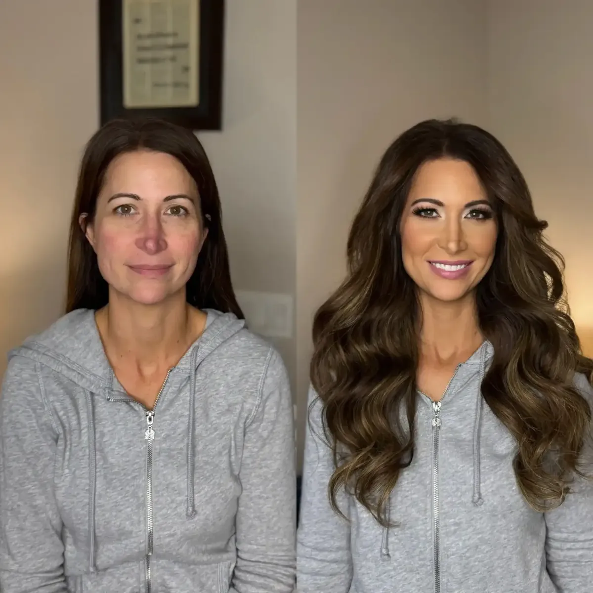 Before and After