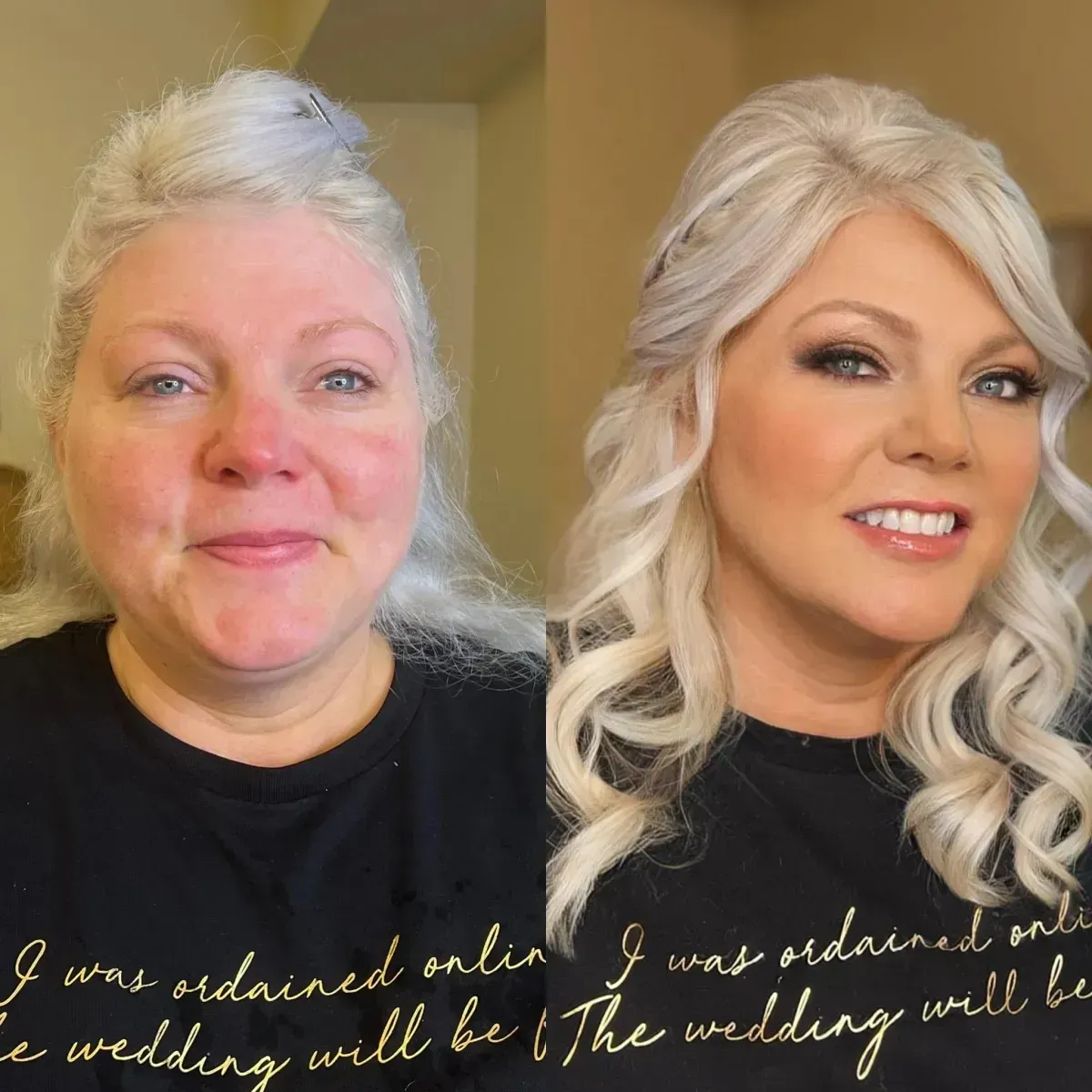 Before and After