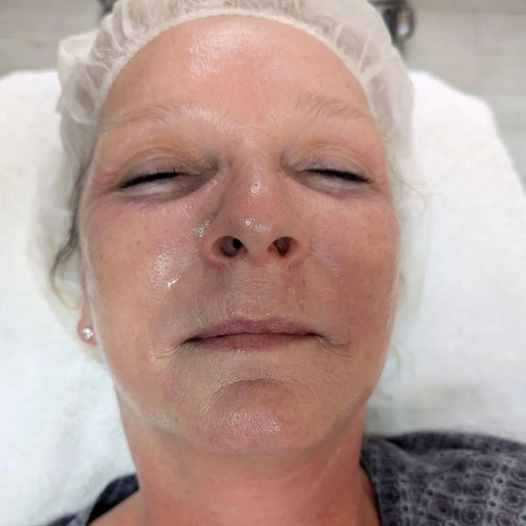 Anti-Aging Behandlung Kosmetikstudio Schönberg