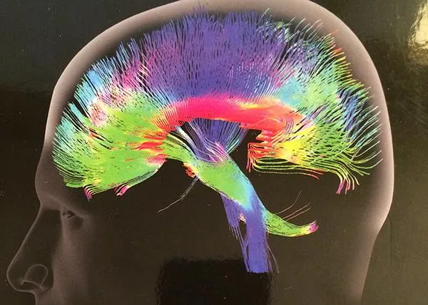 Brain Health