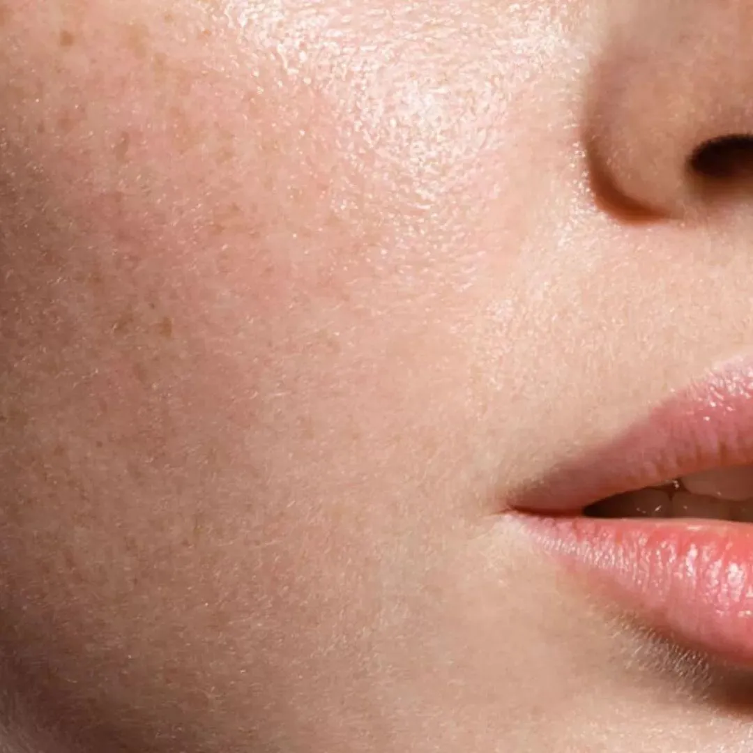 Benefits of NAD on the skin