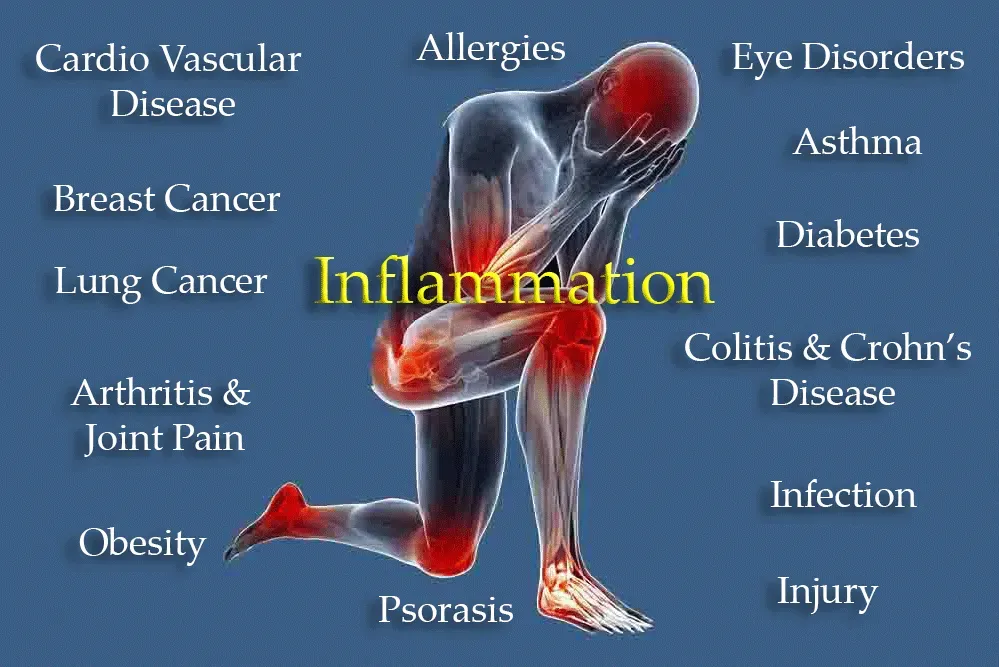 Inflamation image