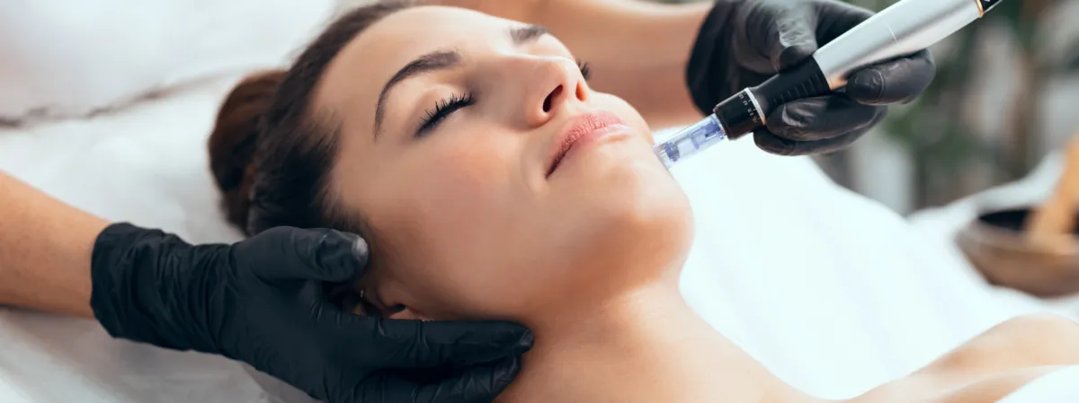 Enhance Collagen Production Through Microneedling: A Comprehensive Guide