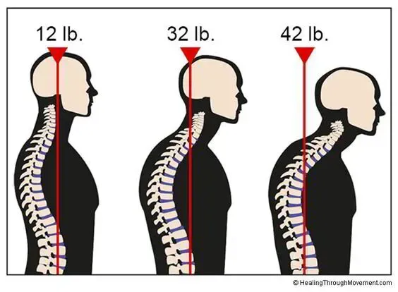 Posture