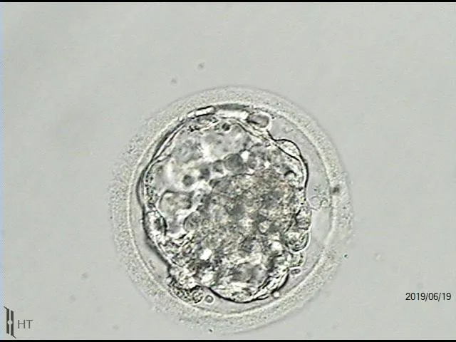 one-embryo-surrogacy