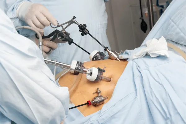 Risks and Complications: Understanding the Potential Side Effects of Bariatric Surgery