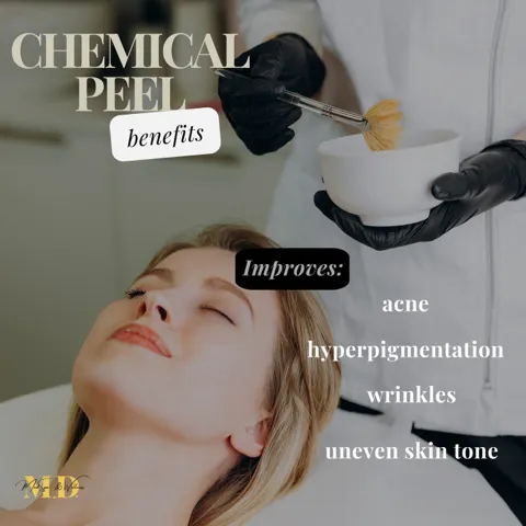 Medical Chemical Peels